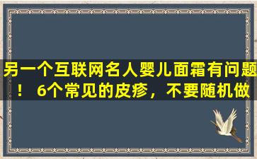 另一个互联网名人婴儿面霜有问题！ 6个常见的皮疹，不要随机做
